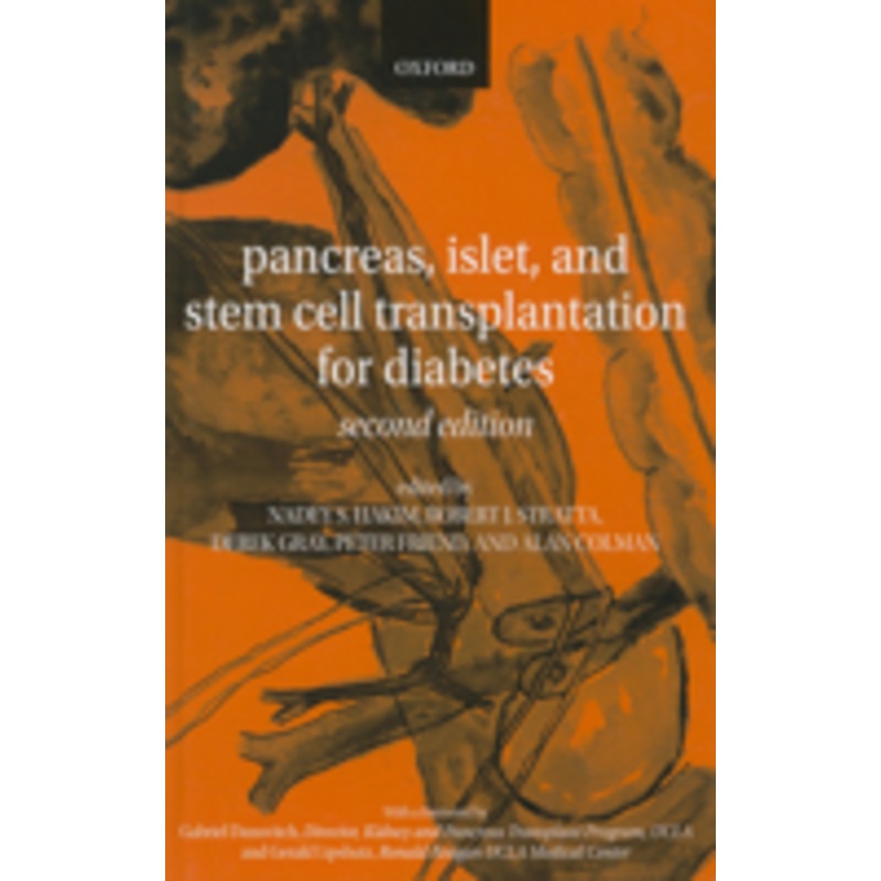 pancreas, islet and stem cell transplantation for diabetes